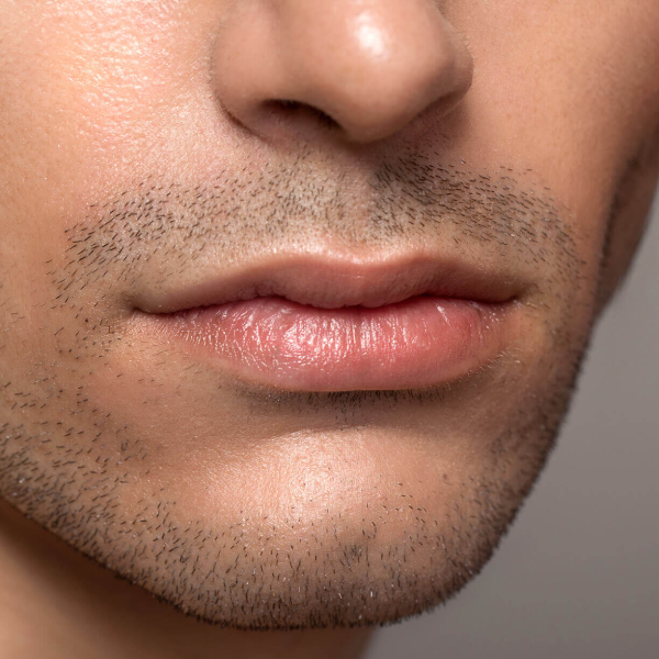 Qu'est-ce que LipLase® ?