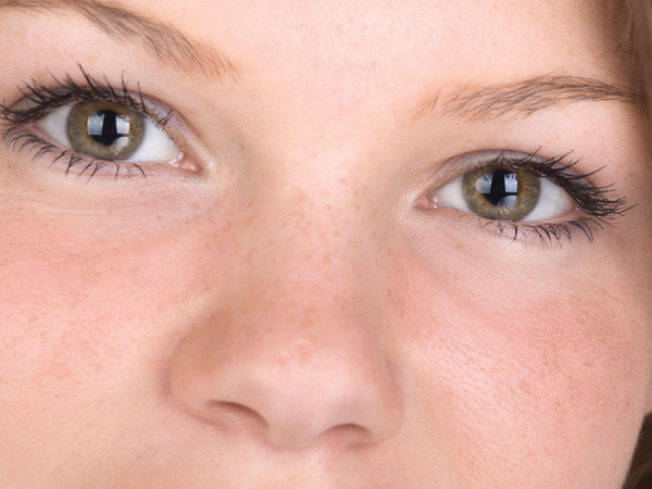 Qu'est-ce que le traitement des lésions pigmentées ?